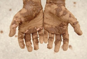 у человека грязные руки 