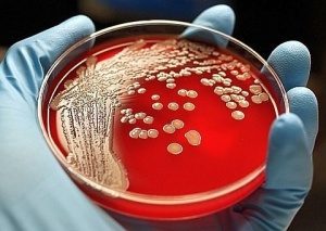 бактериологический метод диагностики инфекции