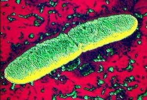 возбудитель чумы под микроскопом