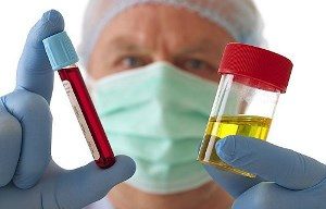 анализы крови и мочи в руках лаборанта