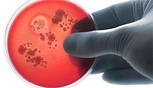 бактерии, вызывающие менингит