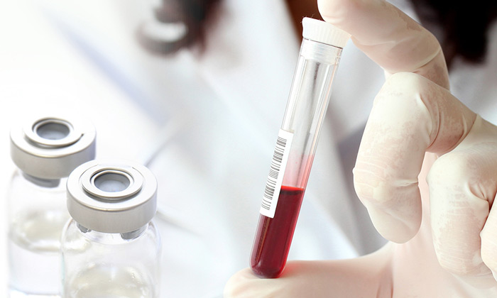 сдача образца крови для теста Т-Спот