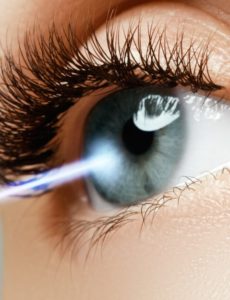 Что такое лазерная коррекция зрения